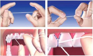 Como utilizar o fio dental